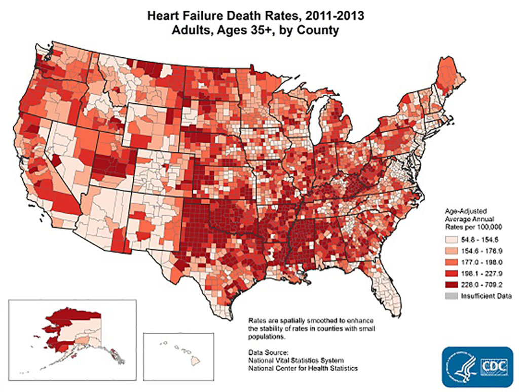 fs_heart_failure Map - Congestive heart failure by county in U.S.
