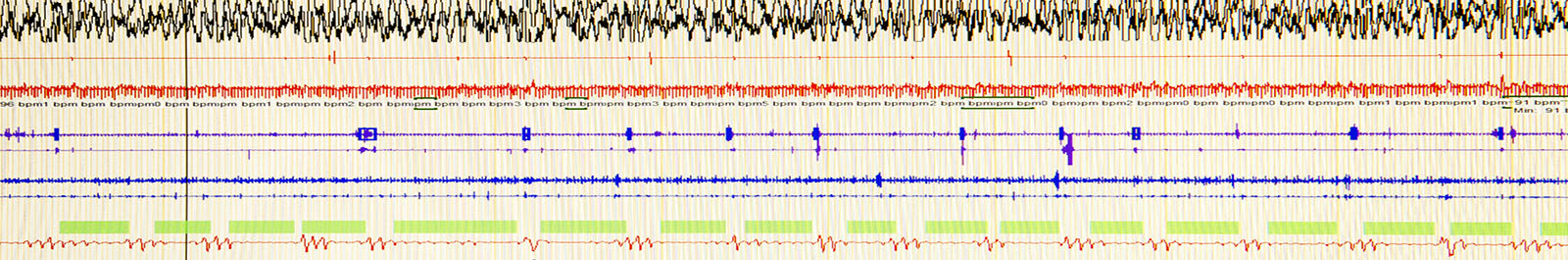 Sleep study screen shot