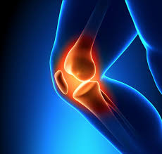 Knee pain illustration